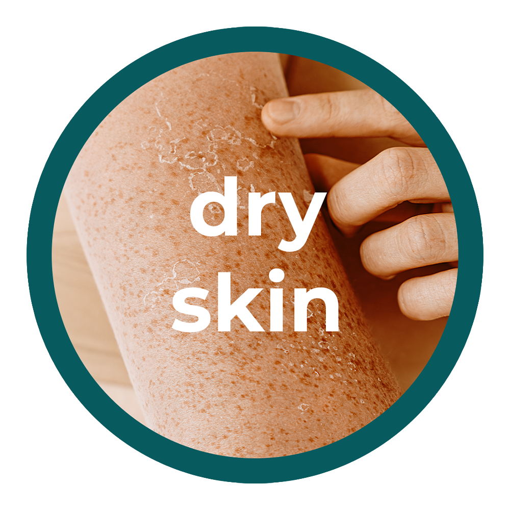 Dry Skin