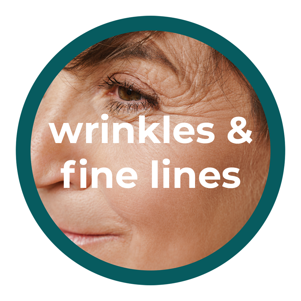 Wrinkles and Fine Lines
